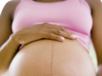Пигментация кожи во время беременности